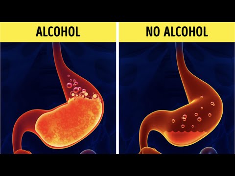 Pregunta: ¿Beber alcohol es bueno para las heridas? Pregunta: ¿Beber alcohol es bueno para las heridas?