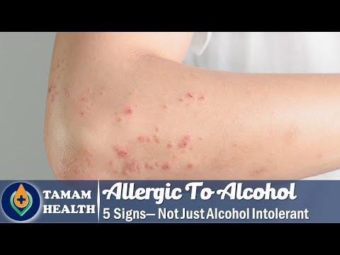 ¿Qué causa la intolerancia al alcohol de inicio repentino?