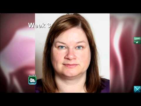 ¿Beber alcohol causa dolor en la mandíbula?