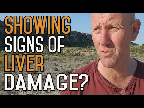 ¿Beber alcohol causa dolor en la mandíbula?