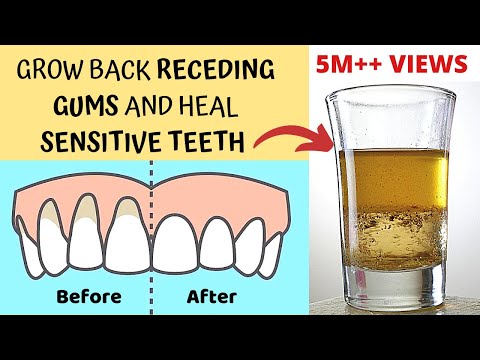 ¿Beber alcohol ayuda a los dientes?