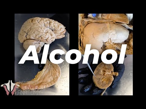 ¿Qué le hace el alcohol a tu mandíbula? ¿Qué le hace el alcohol a tu mandíbula?